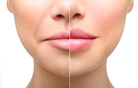Advanced Online Lip Masterclass CPD Accredited
