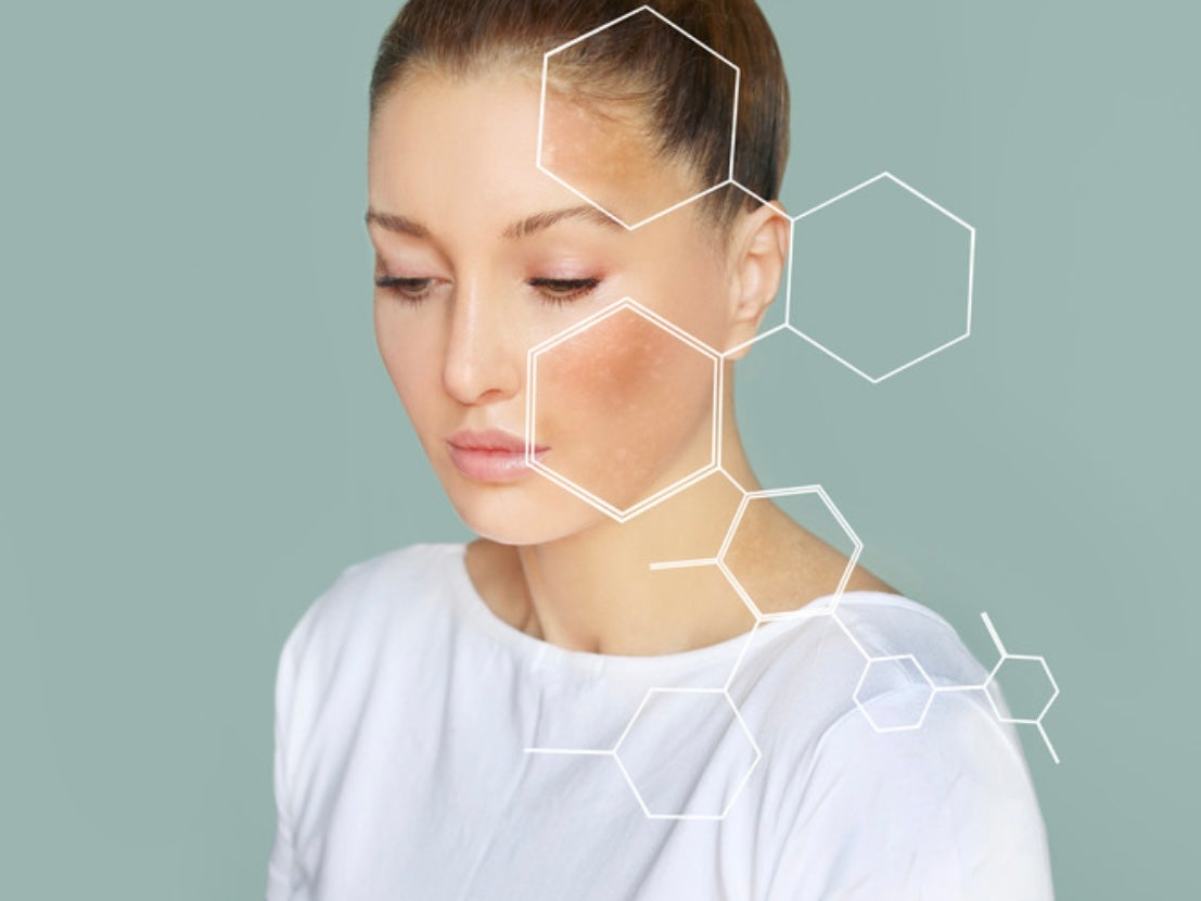 Skin booster face injection demonstration for hydration treatment - online course