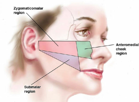 Advanced Online Dermal Filler Training - Cheek Filler with Cannula