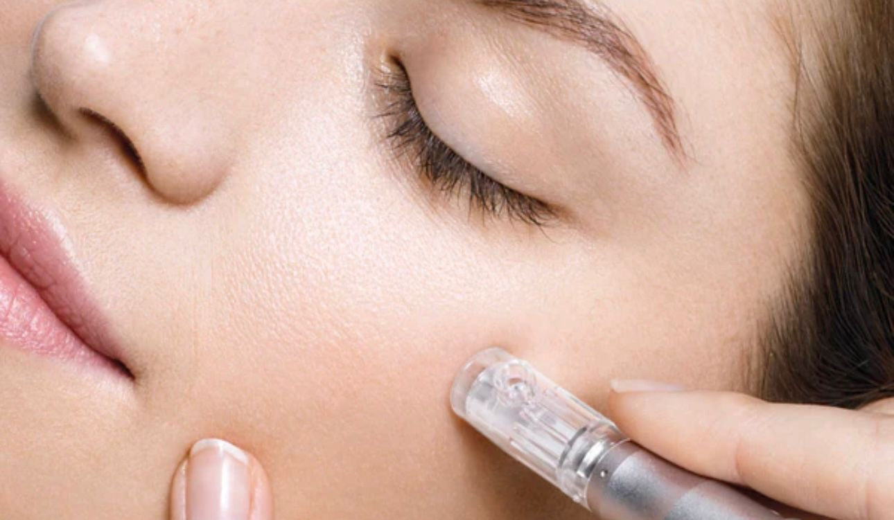 CPD Accredited Microneedling Online Course