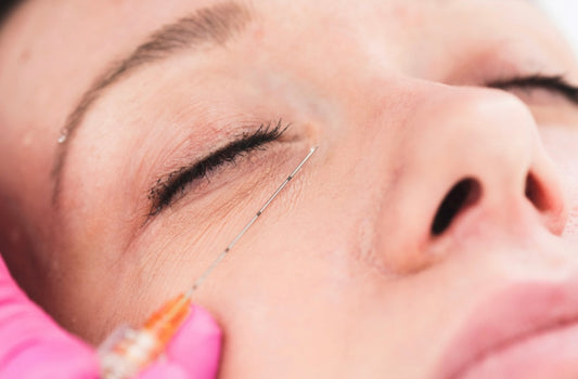 Tear trough dermal filler treatment cannula technique


