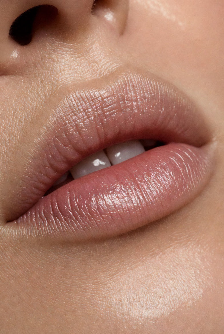 Professional aesthetics training course in Marylebone London featuring advanced lip filler injection techniques, live demonstrations, and Russian Lip masterclass model practice.